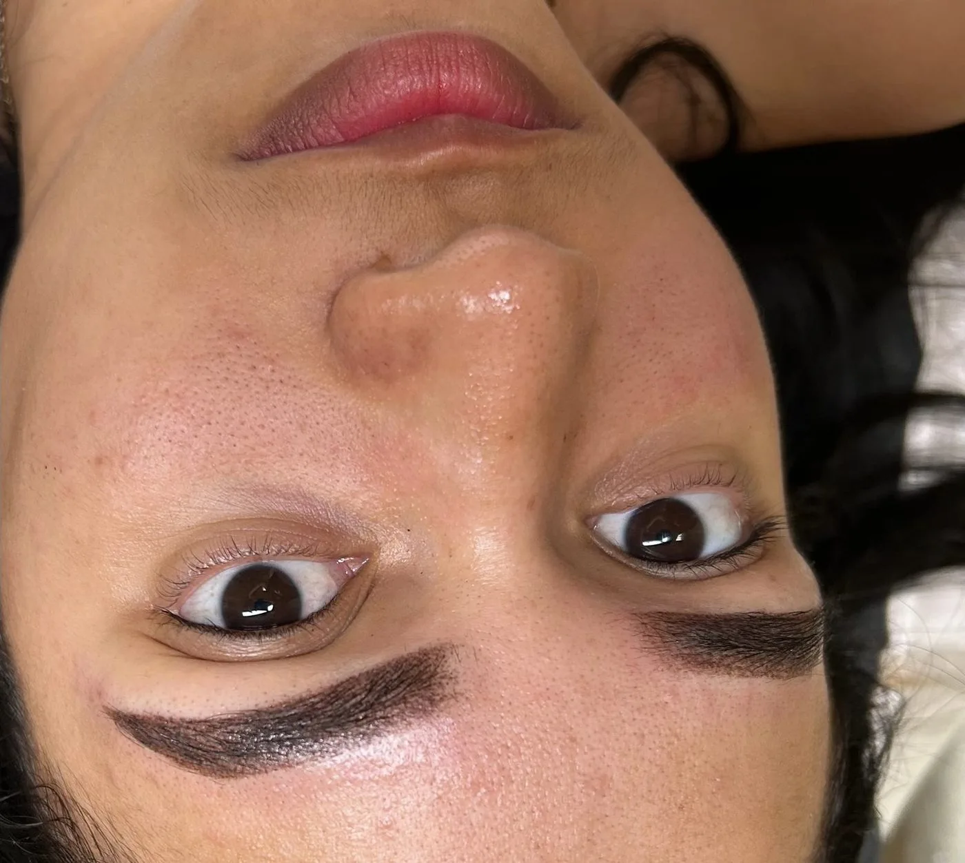 Equipo de tecnología avanzada para rejuvenecimiento y skin tightening